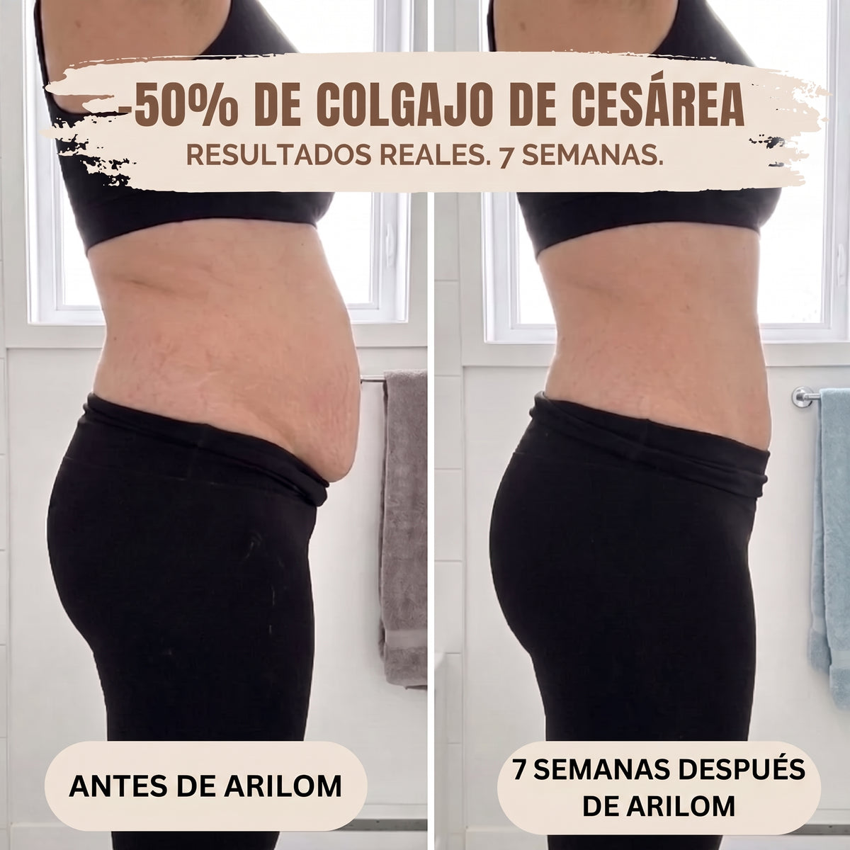 Mutandina Post-Parto — Compressione 360°