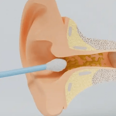 Arilom® - Pulizia auricolare intelligente con tecnologia avanzata